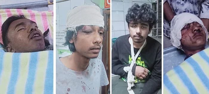 গাজীপুরে মোজাম্মেলের বাড়িতে আহত ৭ জন ঢাকা মেডিকেলে, একজনের অবস্থা আশঙ্কাজনক